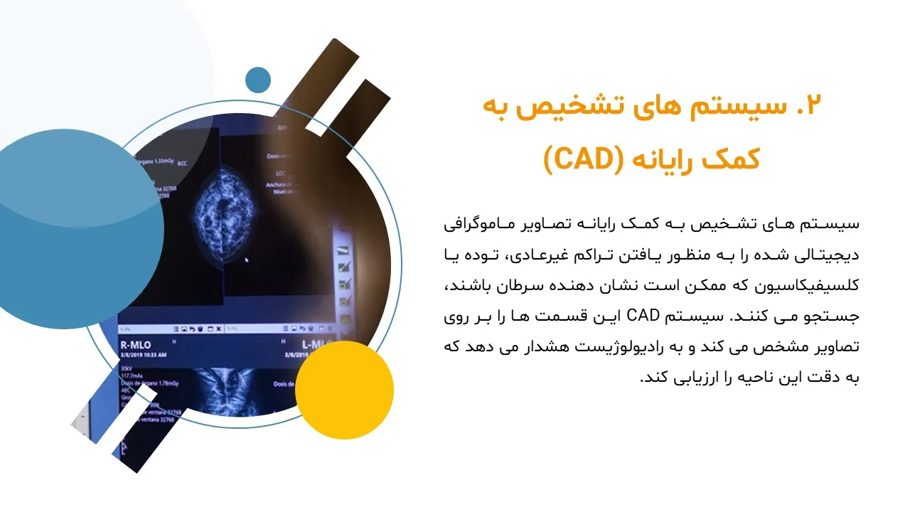 پاورپوینت ماموگرافی