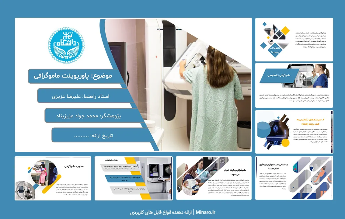 پاورپوینت ماموگرافی