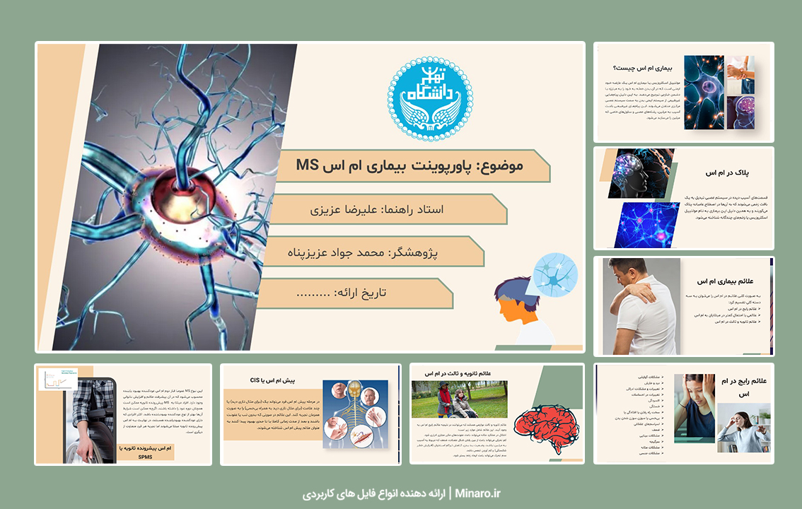 پاورپوینت بیماری ام اس