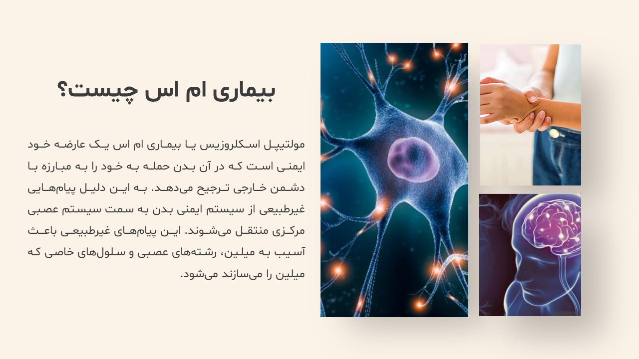 Slide3 پاورپوینت بیماری ام اس