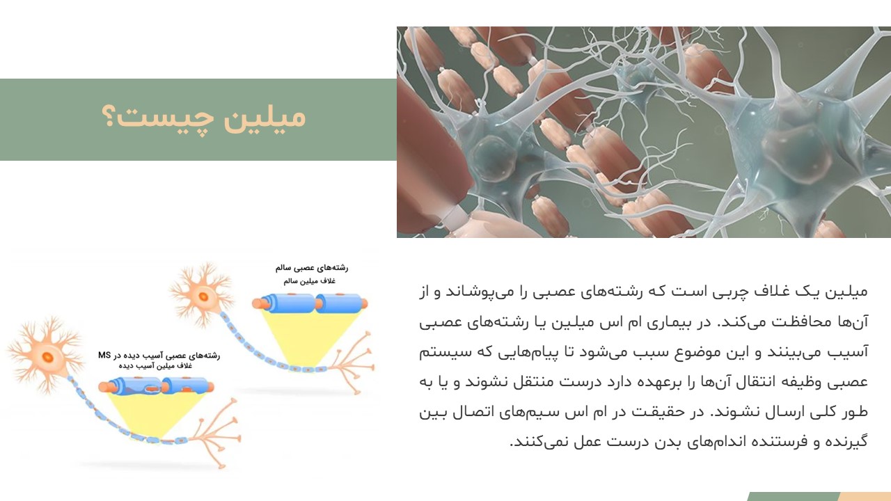 Slide4 پاورپوینت بیماری ام اس