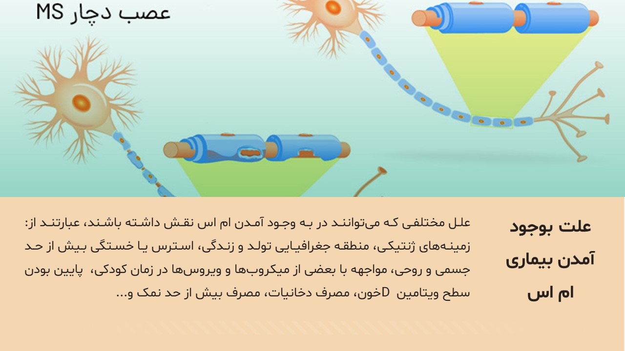 Slide6 پاورپوینت بیماری ام اس