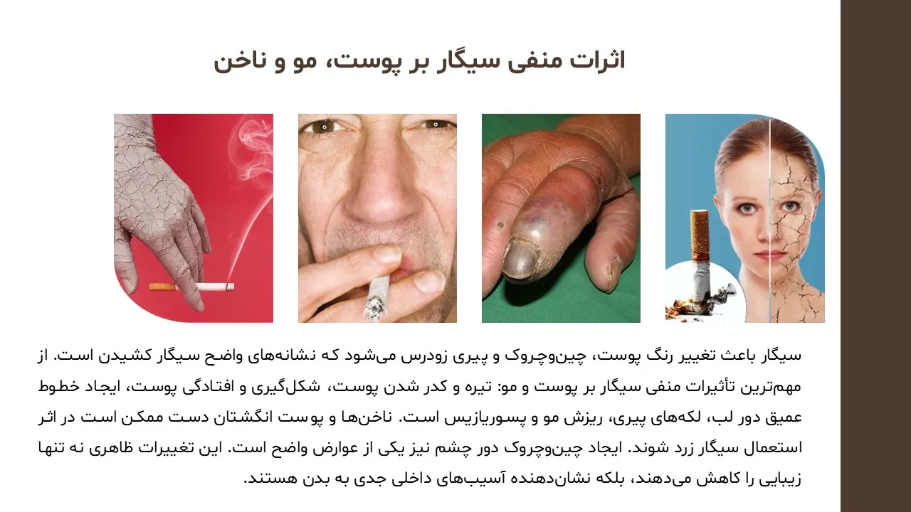 disadvantages-smoking-powerpoint-10 پاورپوینت ضررهای مصرف دخانیات