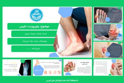 پاورپوینت نقرس