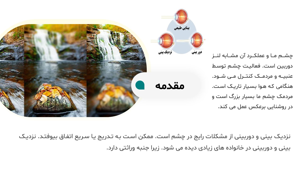 پاورپوینت بیماری های چشم دوربین و نزدیک بین