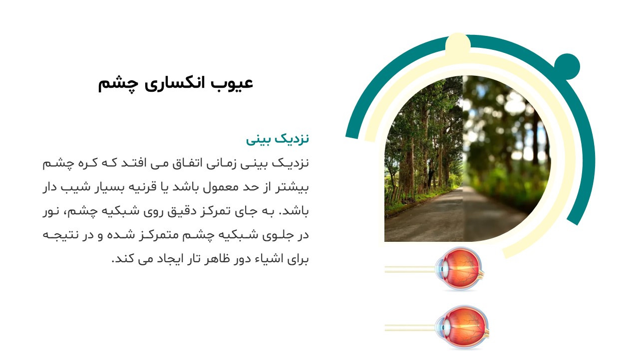 پاورپوینت بیماری های چشم دوربین و نزدیک بین