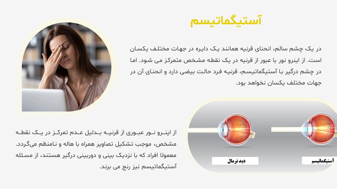 پاورپوینت بیماری های چشم دوربین و نزدیک بین
