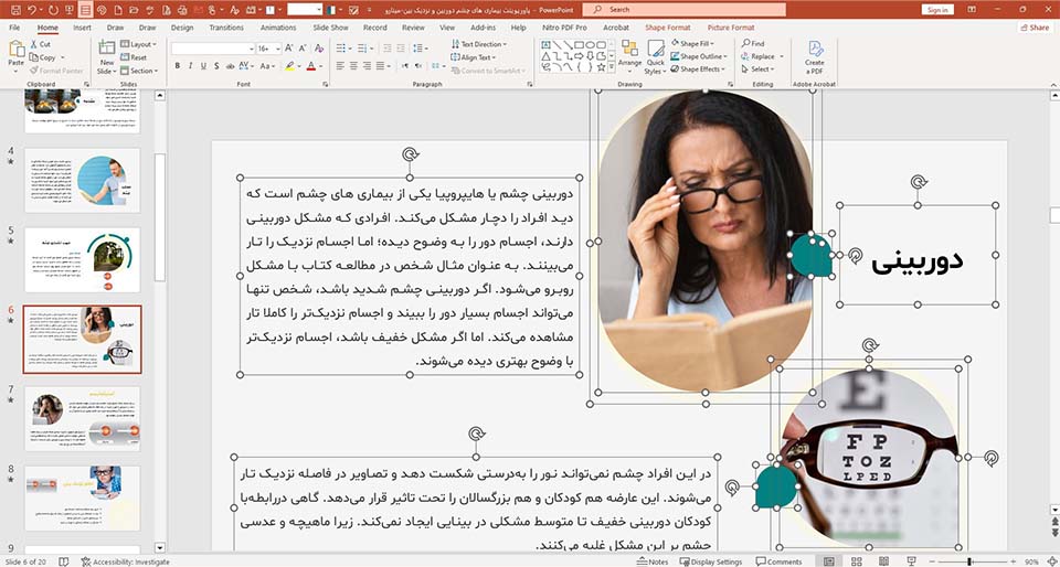 پاورپوینت بیماری های چشم دوربین و نزدیک بین