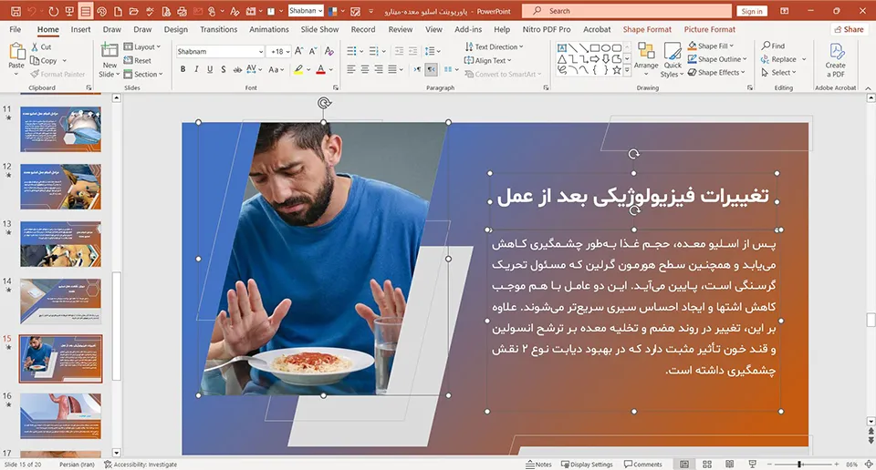 stomach-sleeve-powerpoint-02 پاورپوینت اسلیو معده