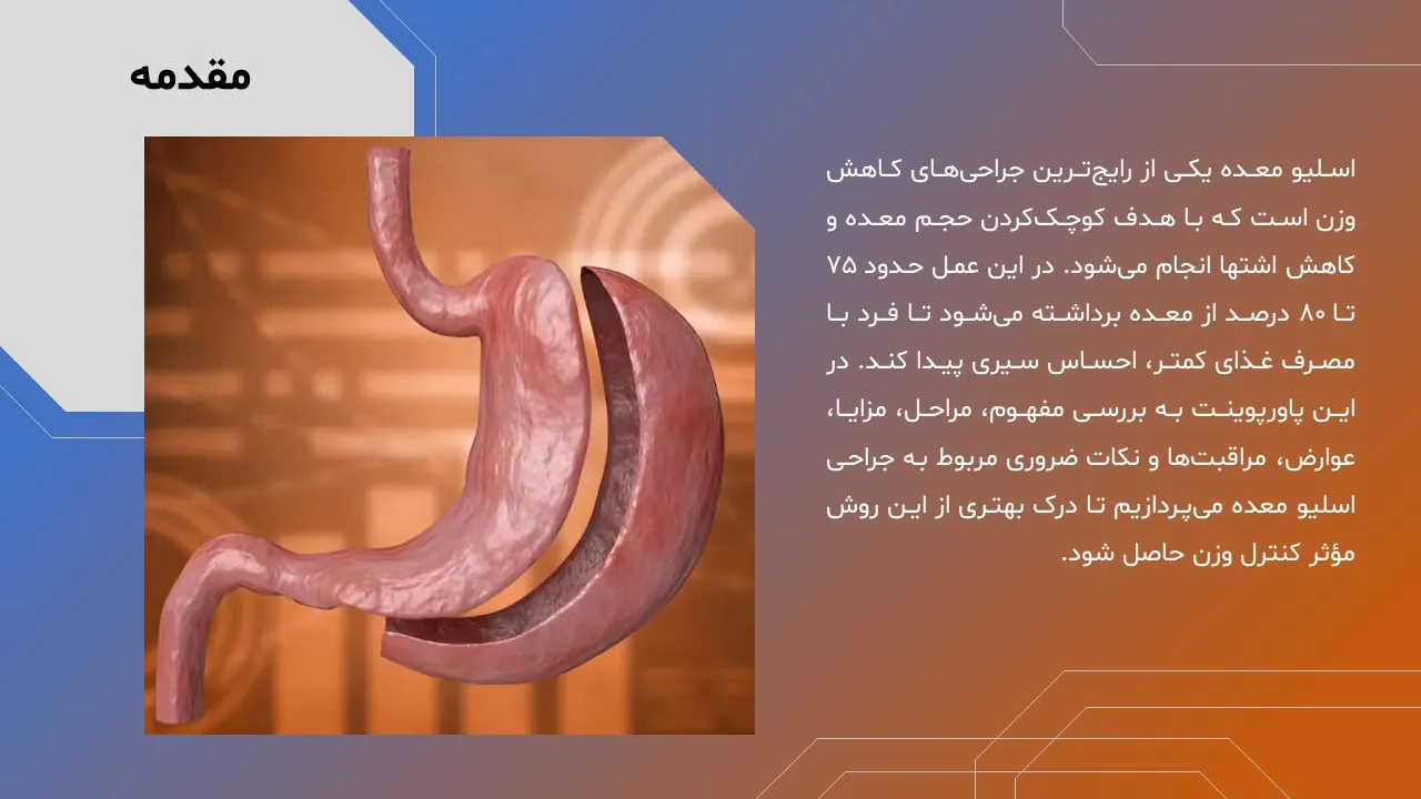stomach-sleeve-powerpoint-04 پاورپوینت اسلیو معده
