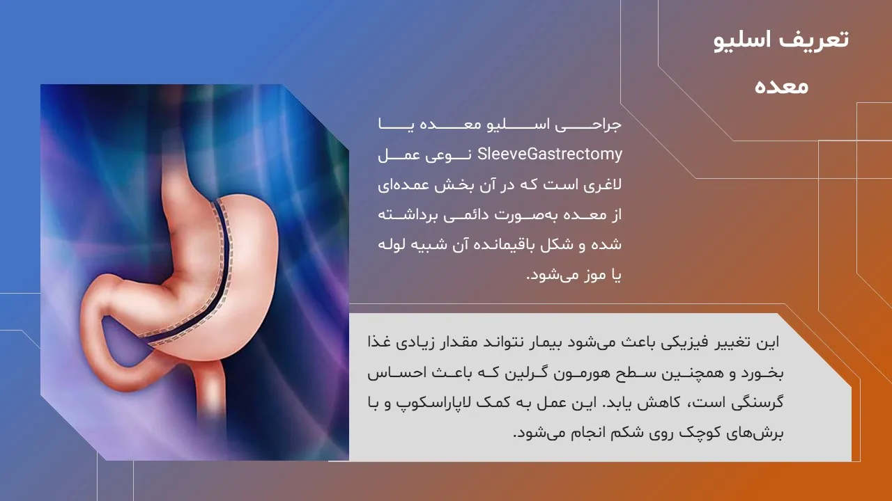 stomach-sleeve-powerpoint-05 پاورپوینت اسلیو معده