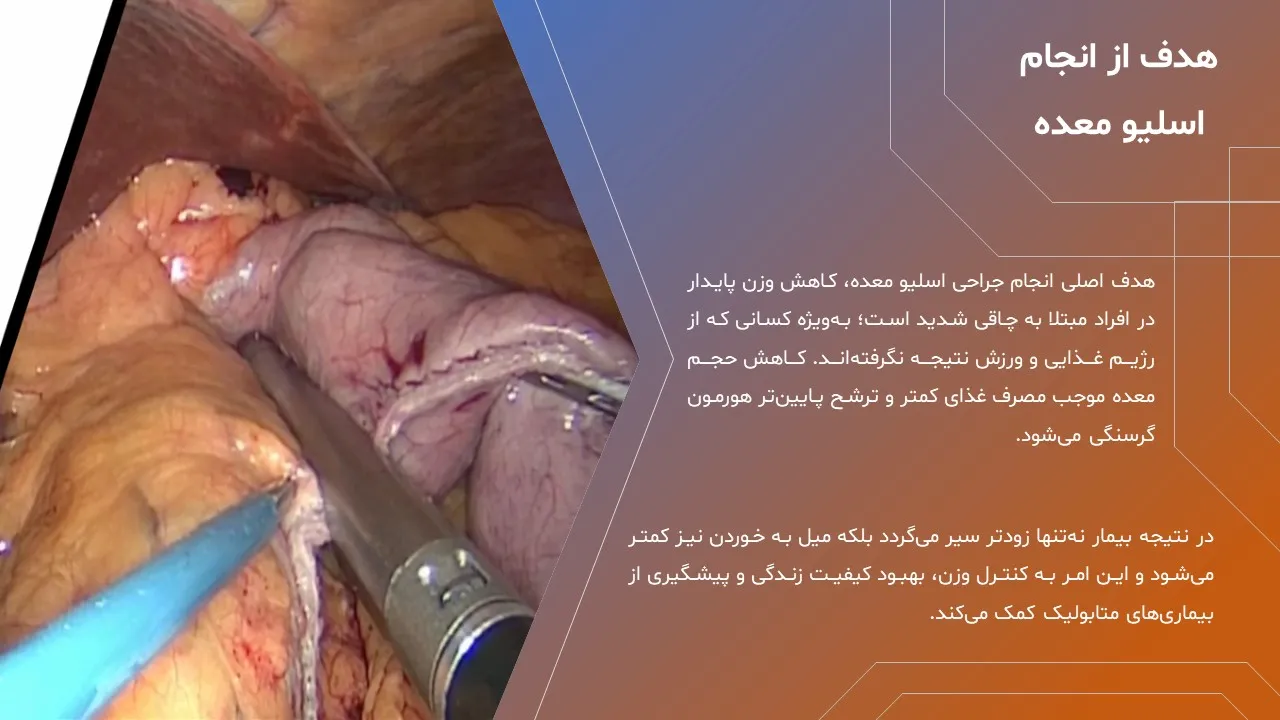 stomach-sleeve-powerpoint-07 پاورپوینت اسلیو معده