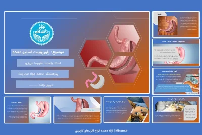 پاورپوینت اسلیو معده