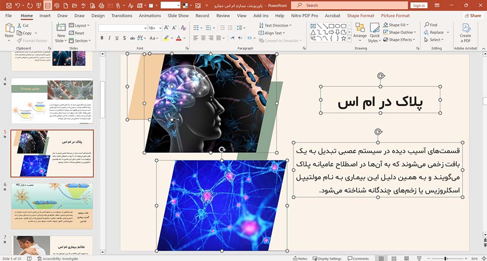 ام اس2 پاورپوینت بیماری ام اس