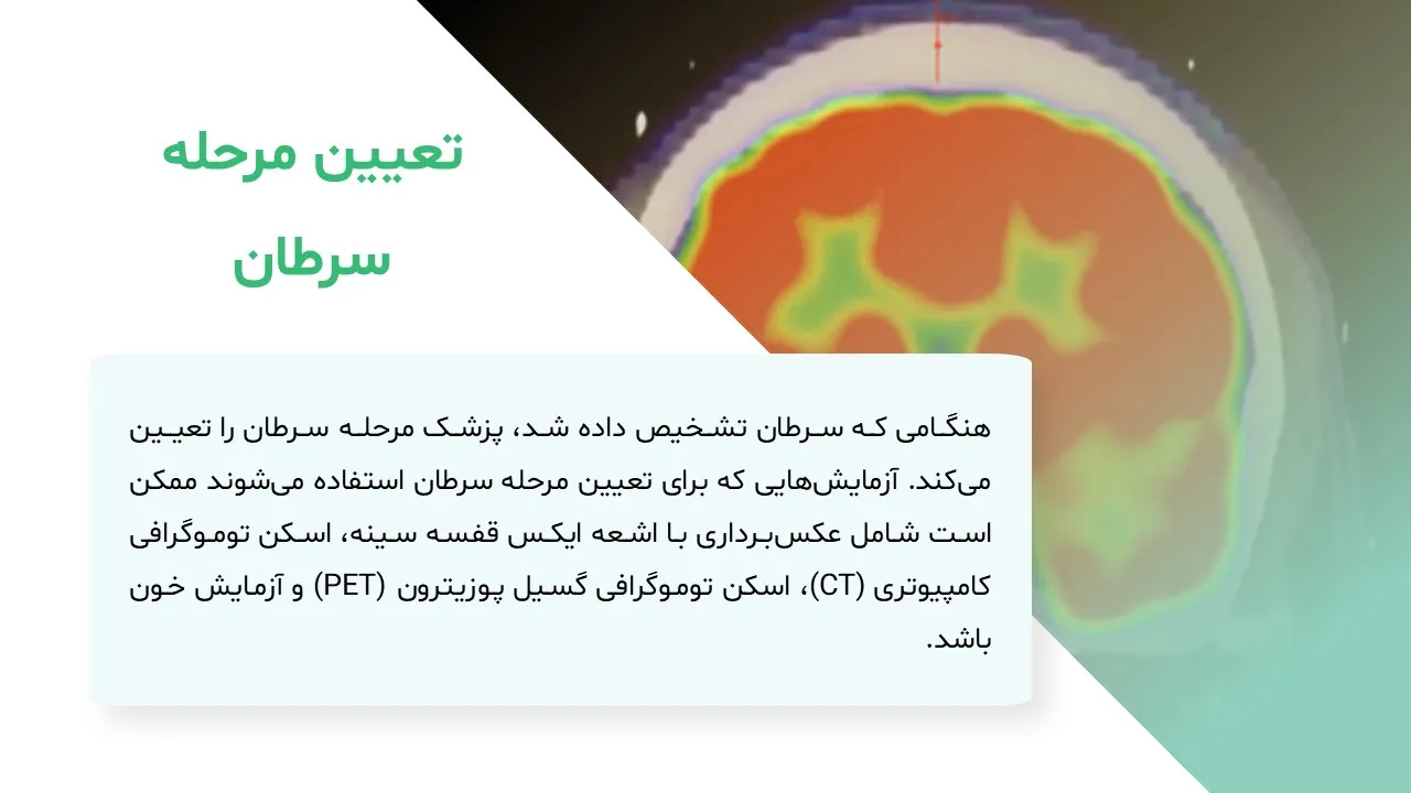 پاورپوینت سرطان رحم