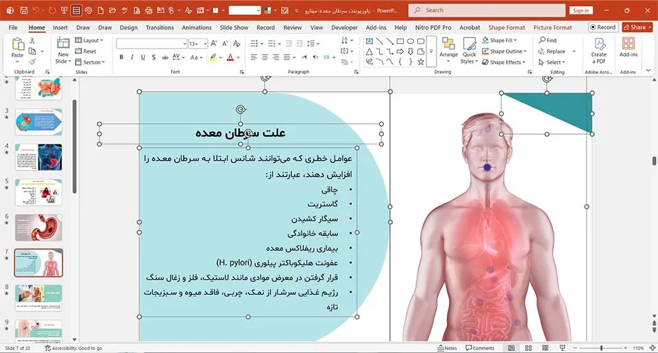 پاورپوینت سرطان معده