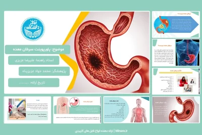 پاورپوینت سرطان معده