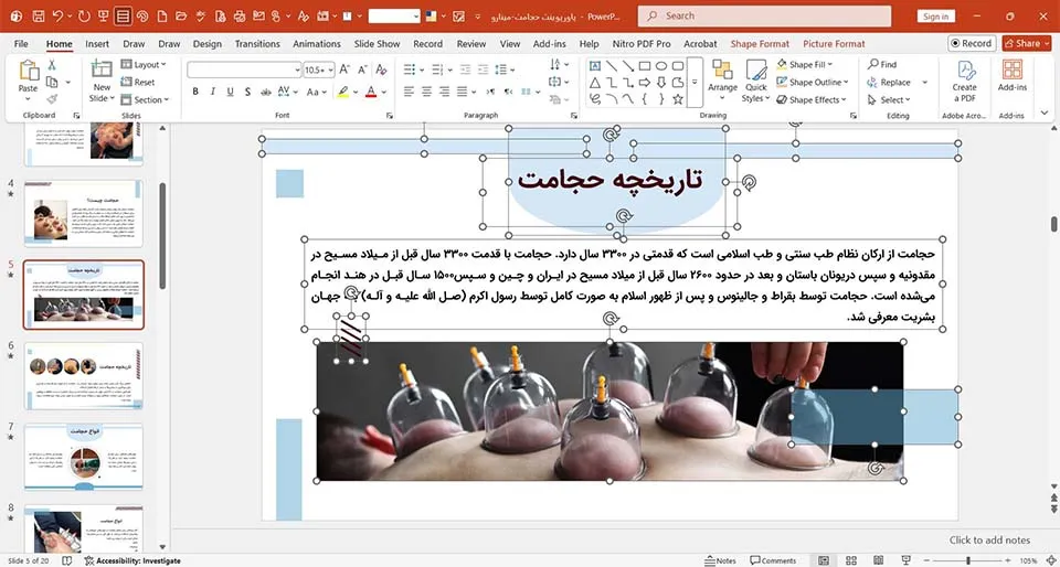 cupping-powerpoint-02 پاورپوینت حجامت