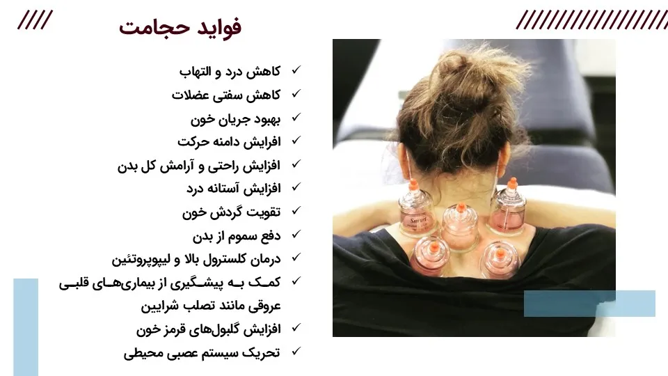 cupping- powerpoint-06 پاورپوینت حجامت