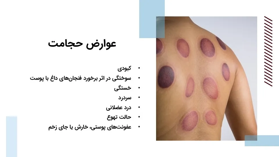 cupping-powerpoint-08 پاورپوینت حجامت