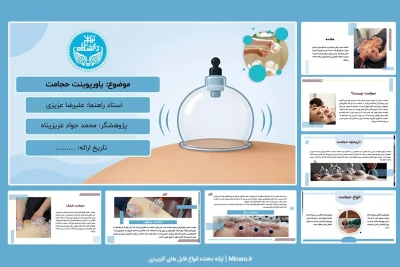 پاورپوینت حجامت