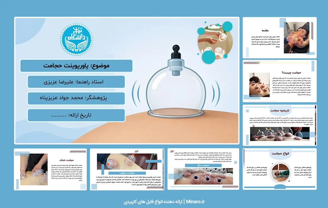 پاورپوینت حجامت