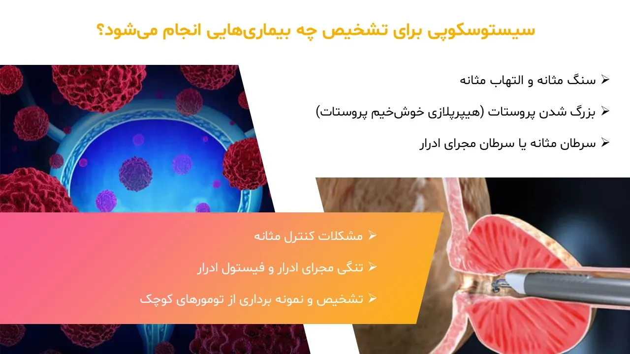 cystoscopy-powerpoint-03 پاورپوینت سیستوسکوپی