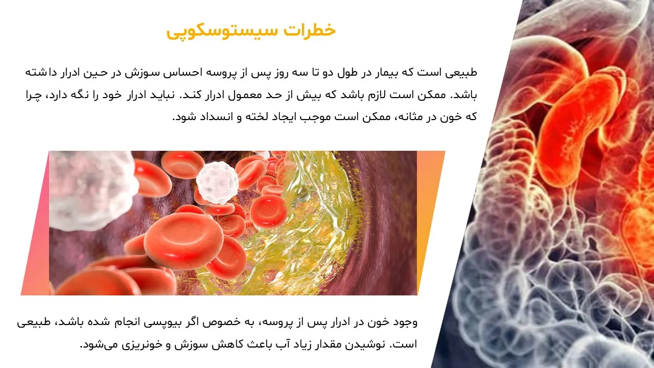 cystoscopy-powerpoint-04 پاورپوینت سیستوسکوپی
