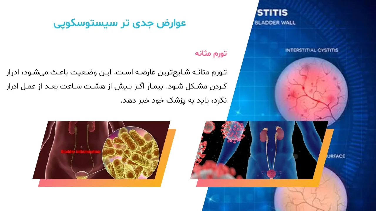 cystoscopy-powerpoint-05 پاورپوینت سیستوسکوپی