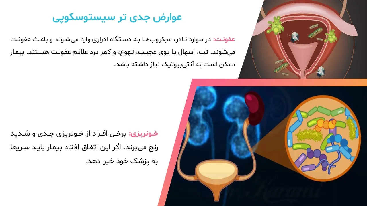 cystoscopy-powerpoint-06 پاورپوینت سیستوسکوپی