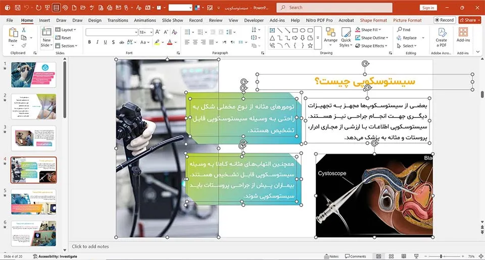 cystoscopy-powerpoint-08 پاورپوینت سیستوسکوپی