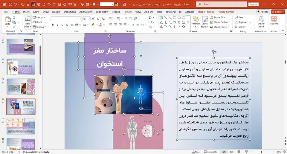 پاورپوینت ساختار و بیماری های مغز استخوان