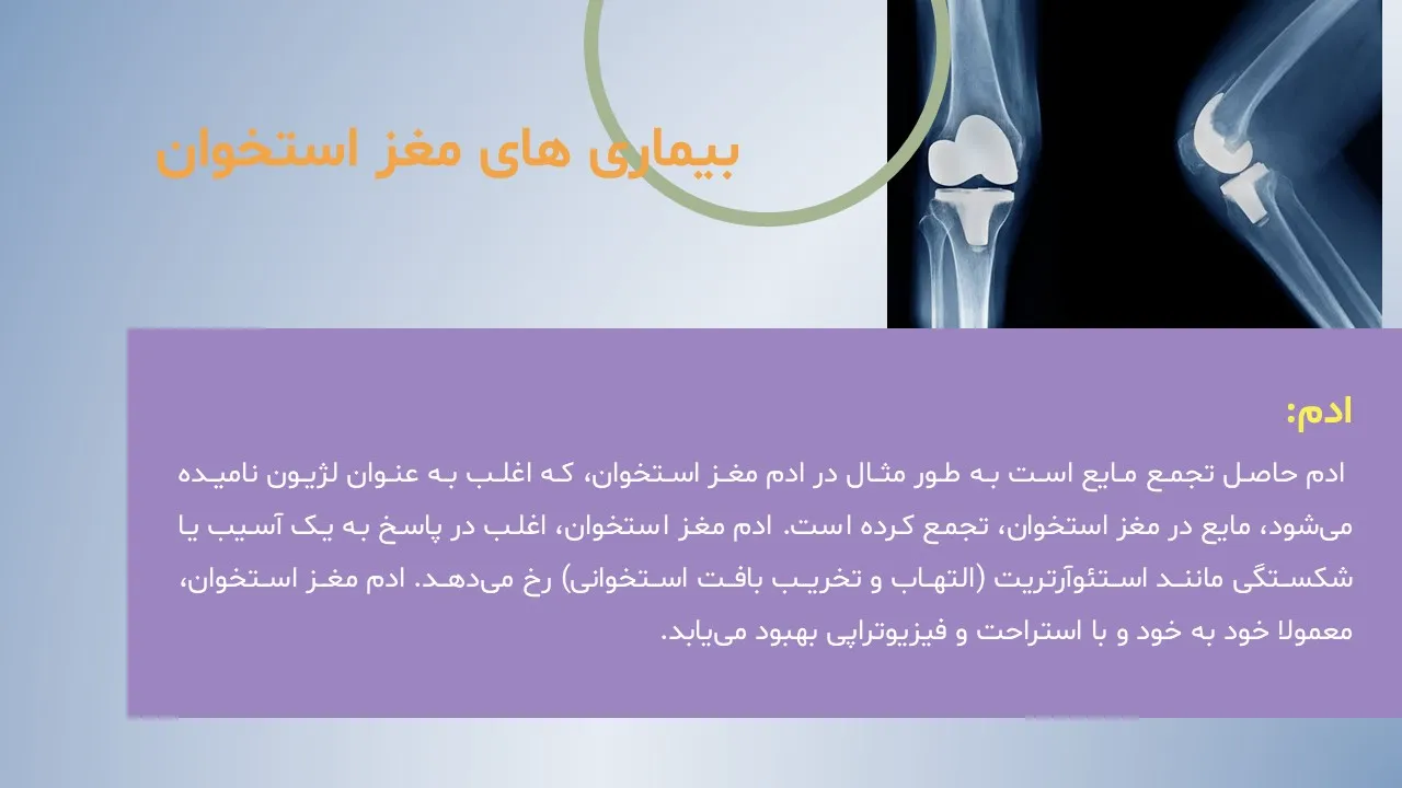 پاورپوینت ساختار و بیماری های مغز استخوان