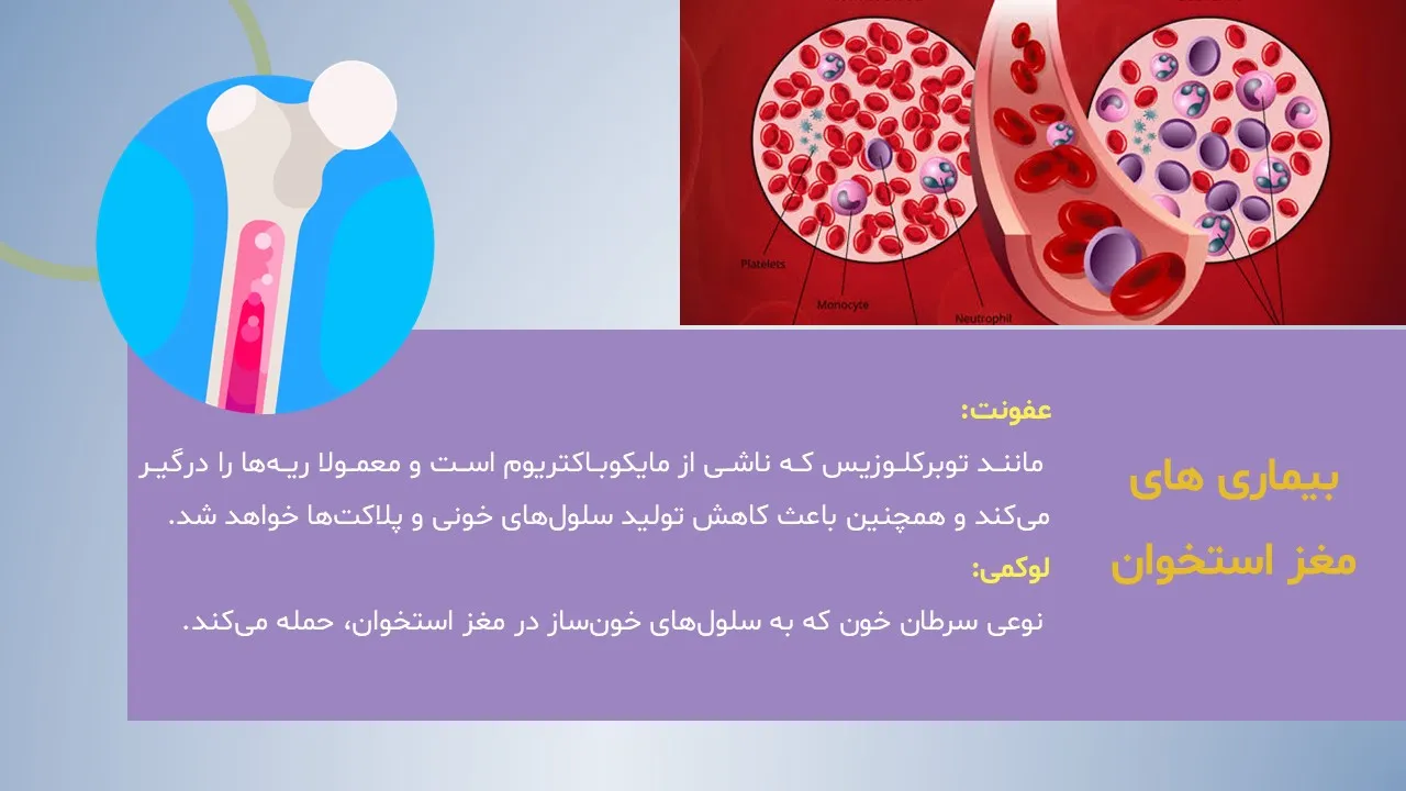پاورپوینت ساختار و بیماری های مغز استخوان