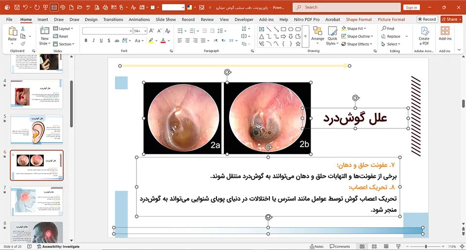 پاورپوینت طب سنتی گوش